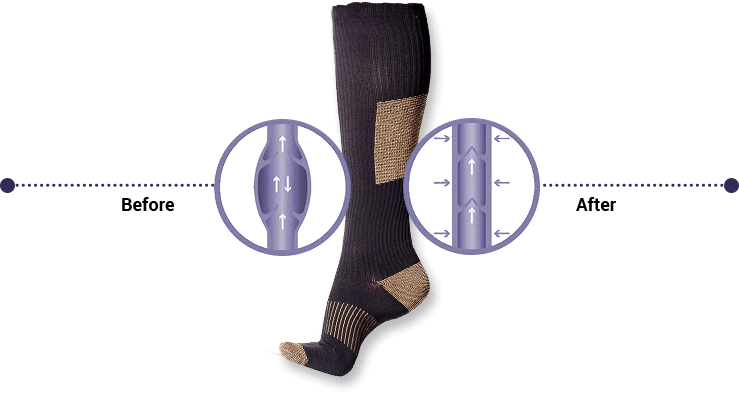 Konpresio Compression Socks Buy Online