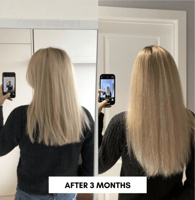 Moerie Before & After Results