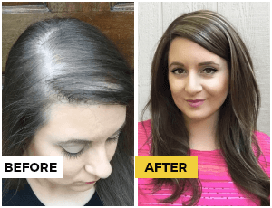 Abundant Before & After Results