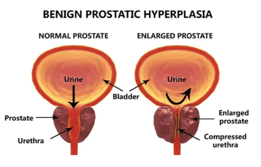 ProstateFlux Ingredients