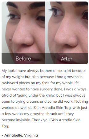 SkinBliss Customer Reviews