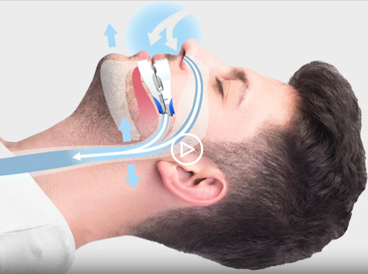 Vital-Sleep-Anti-Snoring-Mouthpiece-For-Restful-Sleep