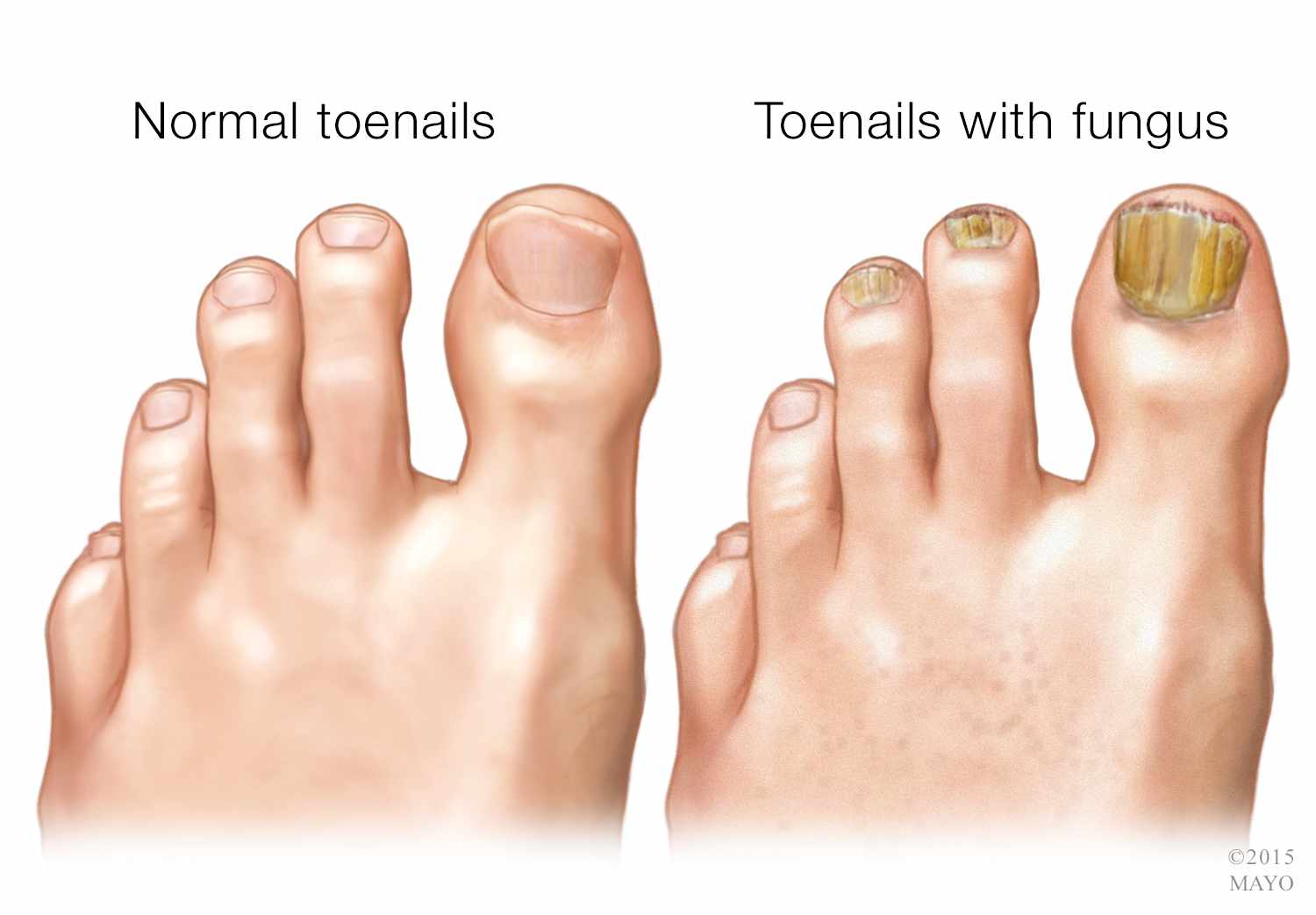 SupraNail Supplement