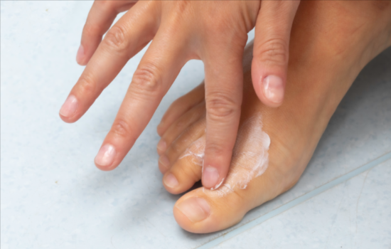 colloidal silver for toenail fungus