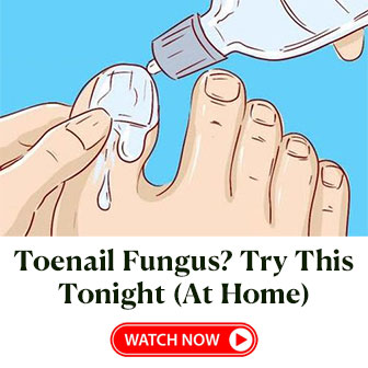 Toenail Fungus Treatment #1