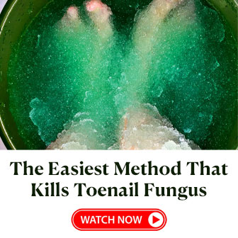 Toenail Fungus Treatment #3