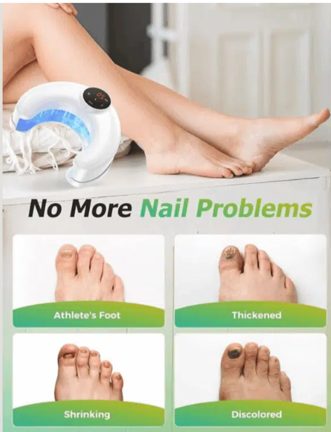 LumoNail After & Before