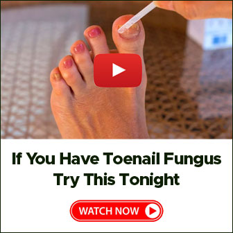 Toenail Fungus Treatment #2