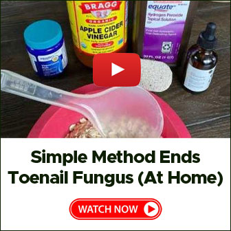 Toenail Fungus Treatment #3