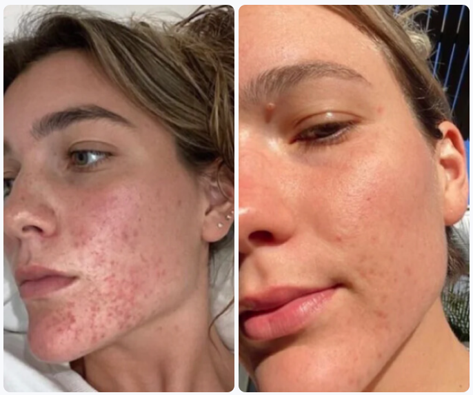 Clarexin Intestinal Parasite Cleanse Australia Customer Reviews & Complaints