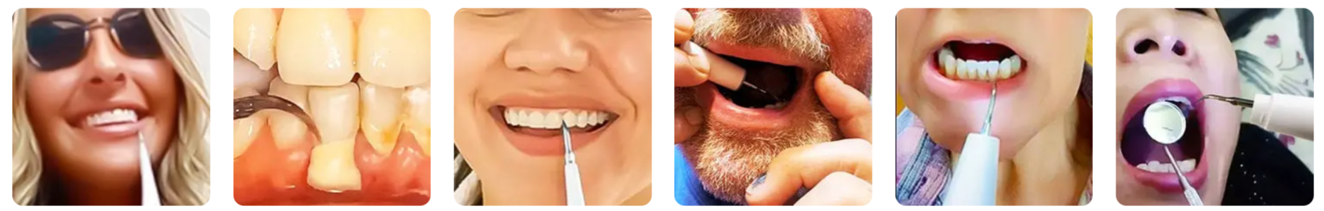 Denta-Blast-Ultrasonic-Tooth-Scraper-Customer-Reviews