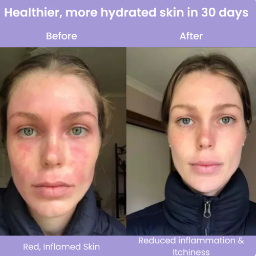 Lucinn Pro Filtered Showerhead benefits