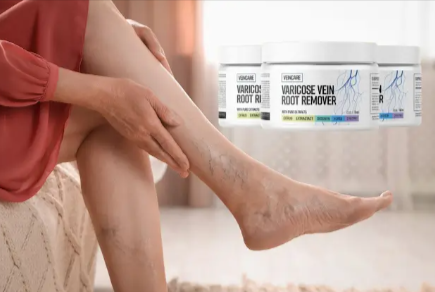 Veincare Varicose Vein Root Remover Benefits