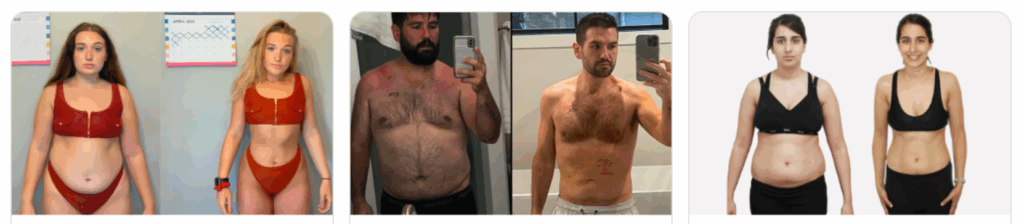 Ballon Slim Customer Reviews