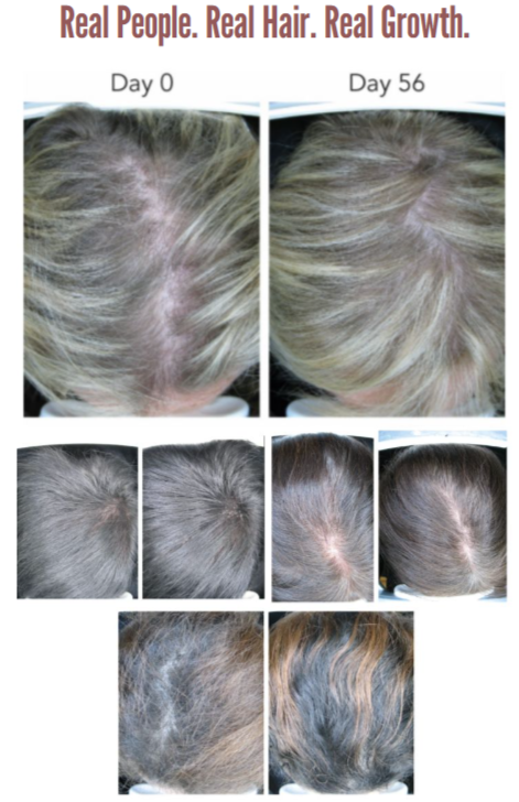 Purality-Health before after use