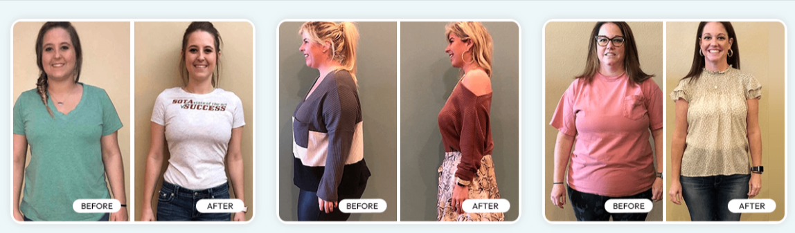 Trimology Weight Loss After - Before