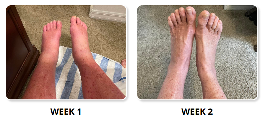 NativePath-Antarctic-Krill-Oil-Benefits