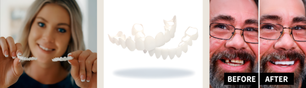 Shiny Smile Veneers benefits