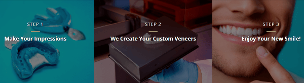 Shiny Smile Veneers usage