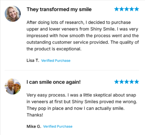 Shiny Smile Veneers user