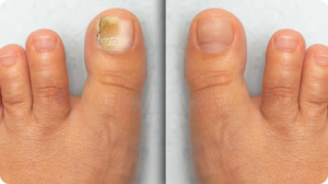 fungabeam experience