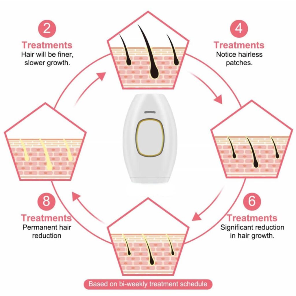 Glokore IPL Hair Remover-treatment results