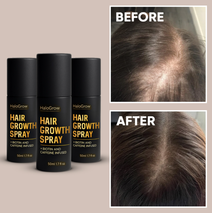 HaloGrow Hair Growth Spray Customer