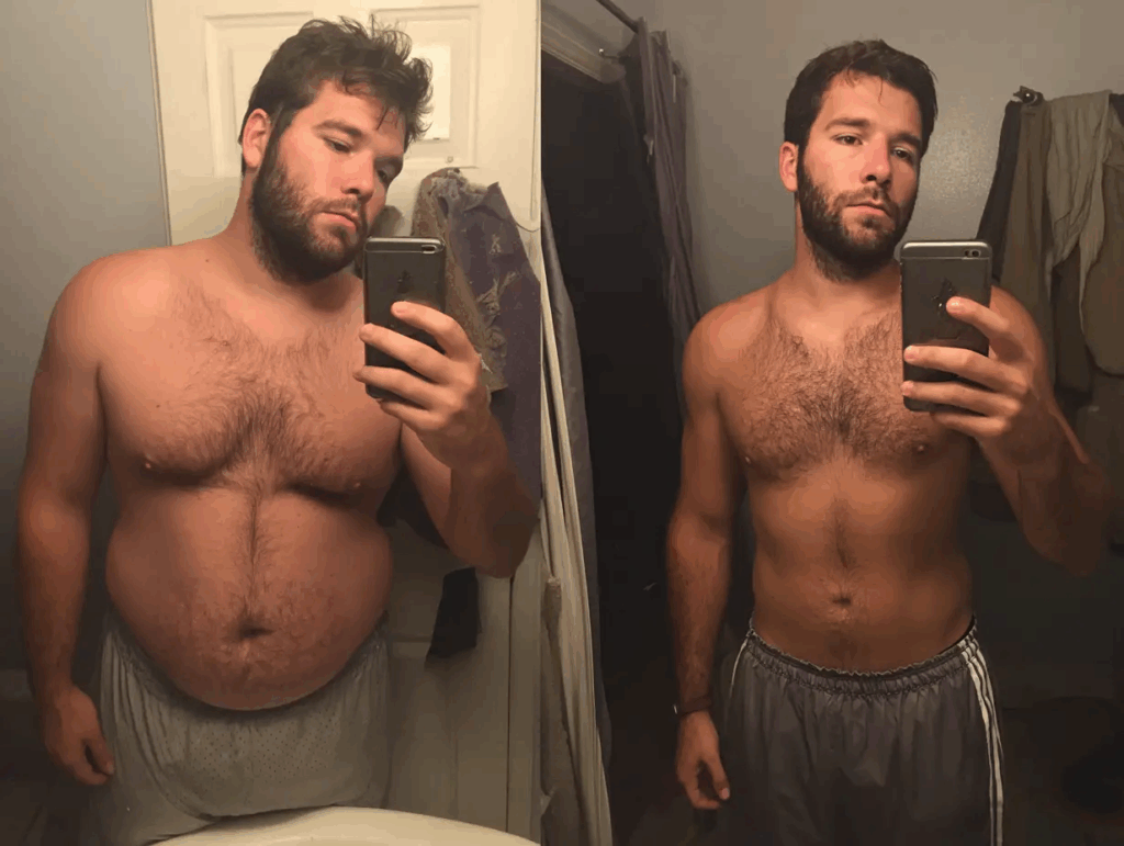 MEDVi GLP-1 Weight Loss