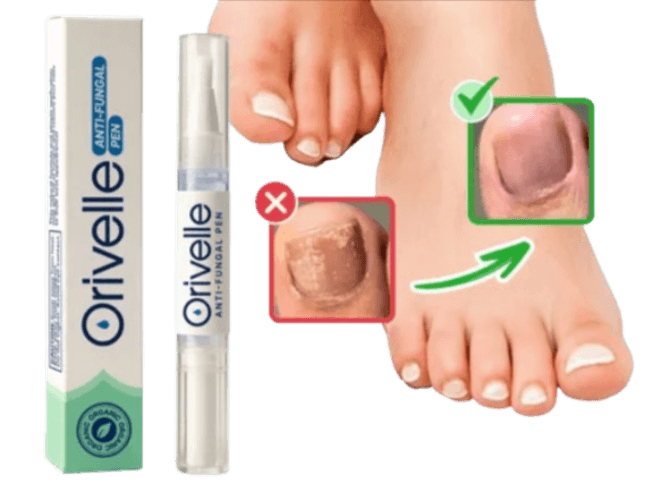 Orivelle Nail Fungus Pen Benefits