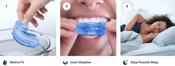 SleepZee Anti Snoring Mouthpiece use