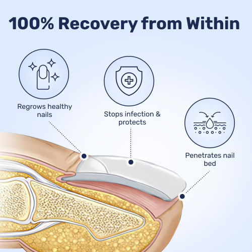 WellaNail Fungus Treatment-How does it work