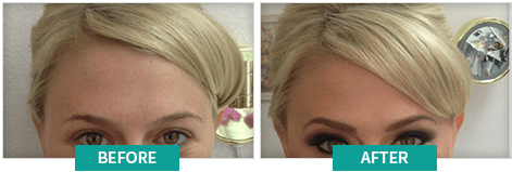 BioGrow Advanced Hair Regrowth cus 2