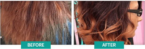 BioGrow Advanced Hair Regrowth cus1