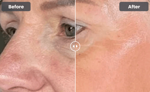 Glokore-Bio-Collagen-Mask-Before-And-After