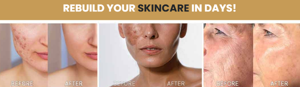 Kim’s Skincare Protocol include