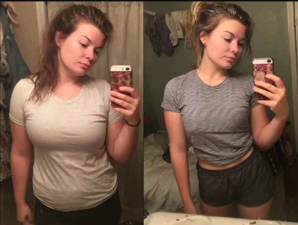 MEDVi GLP-1 Injections user