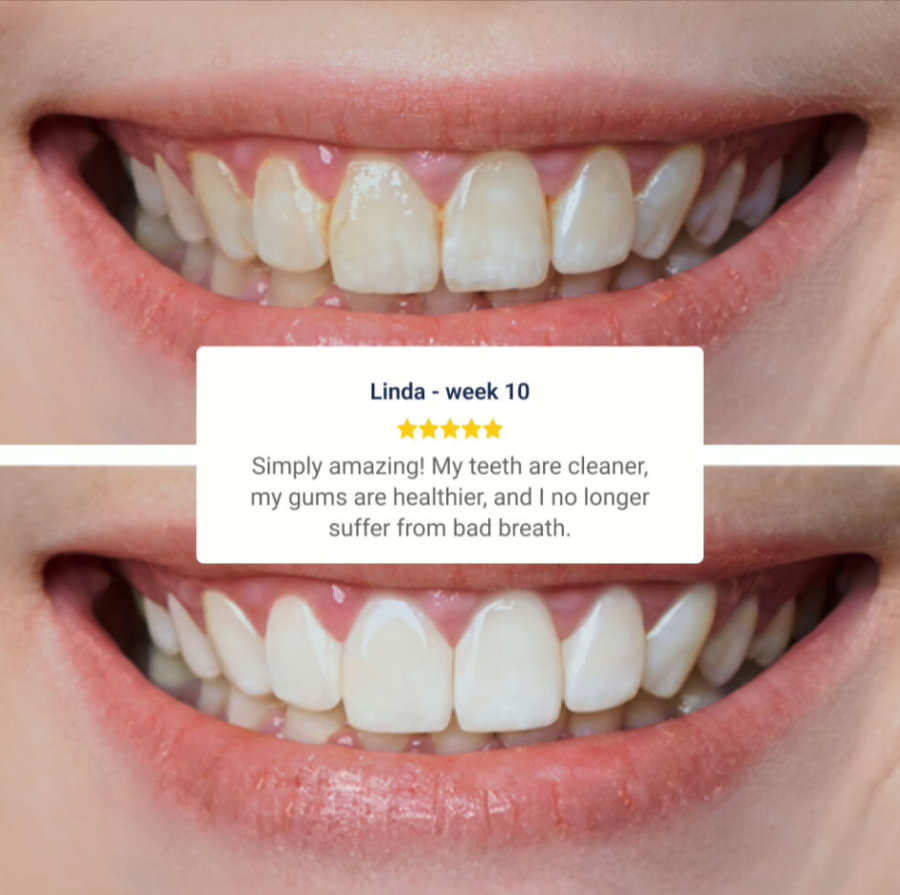 WellaWhite-Water-Flosser-Customer-Reviews