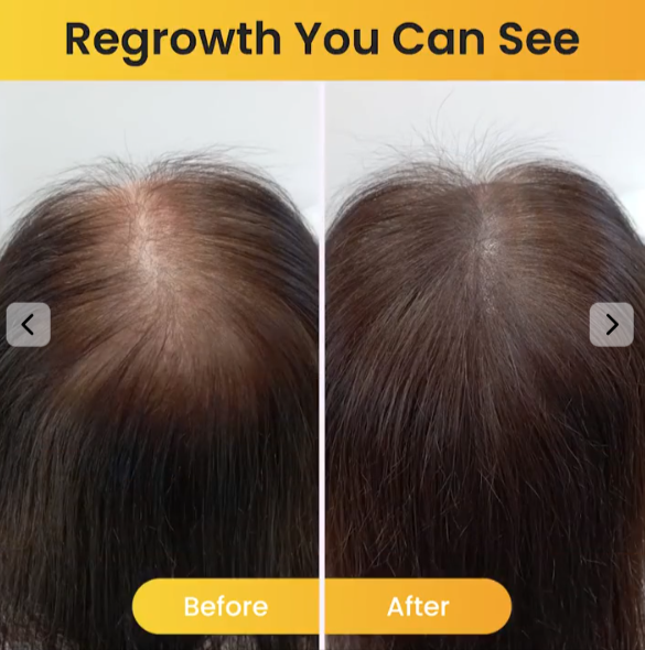 WellaNaturals-Hair-Growth-Oil use