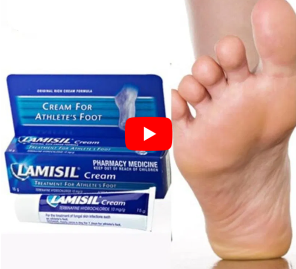 Antifungal Cream Correctly video