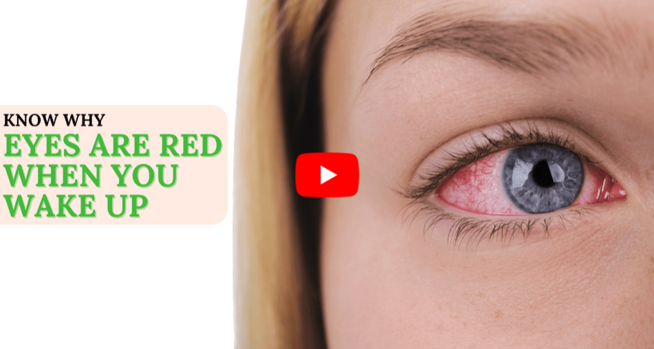 Blood Around the Eye Area video