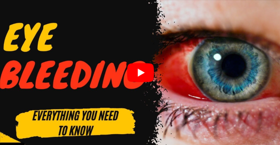 Blood in the Eye video