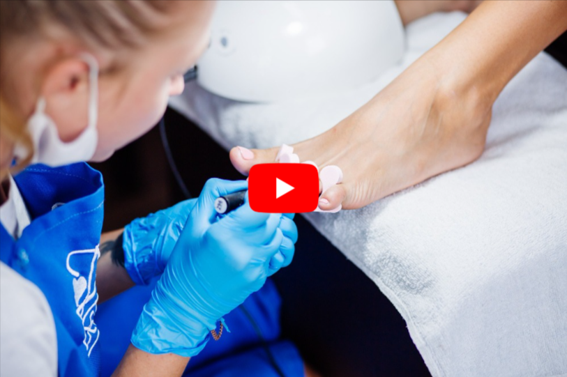 Nail Fungus Treatments video