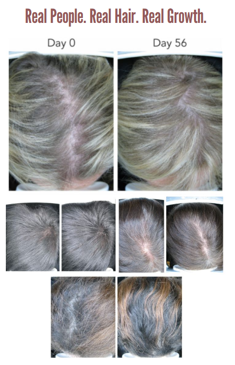 Purality Health Hair Renewal Benefits
