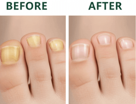 Nail Refresh benefit