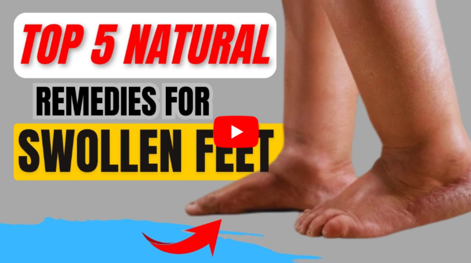 Swelling Reducer Strategies video