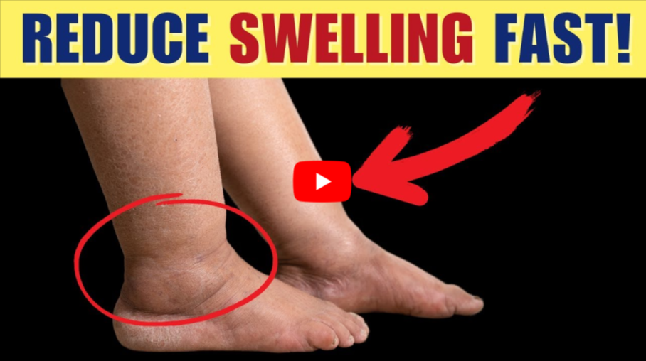 Swelling Reducer for Feet and Legs video