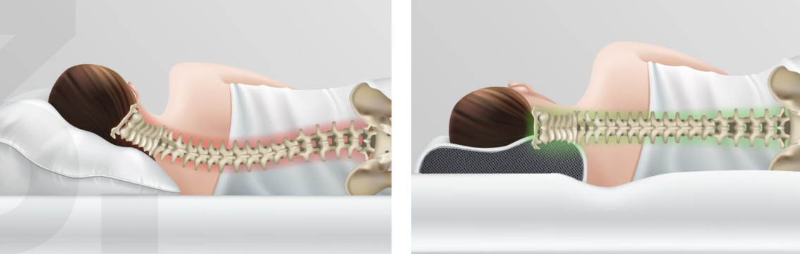 Derila Memory Foam Pillow vs