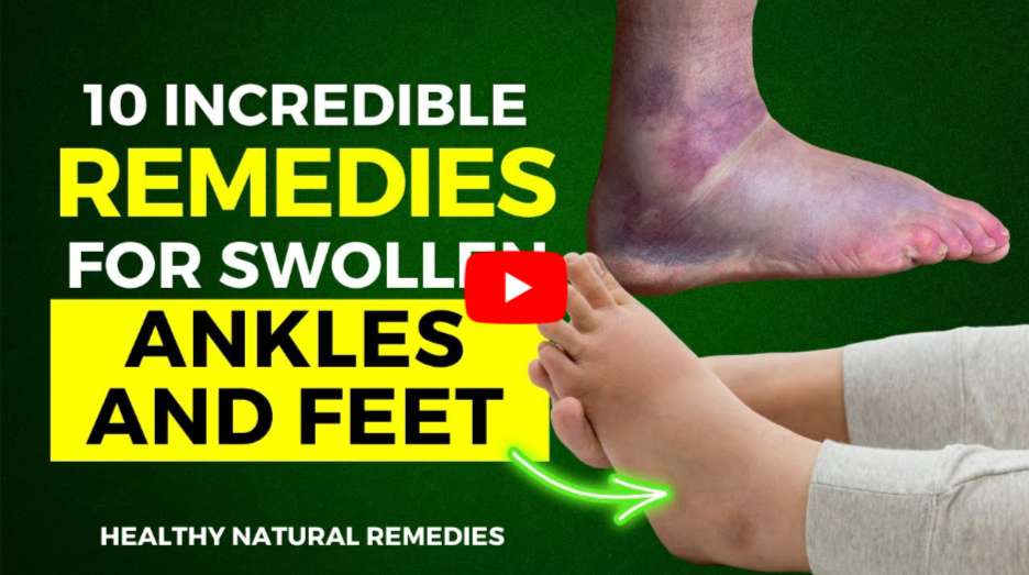 Herbal Remedies for Edema in Feet and Ankles