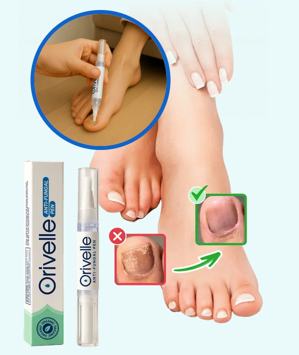 Orivelle Fungus Pen Benefits