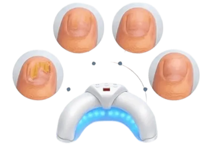 PODOclear LLLT Device Benefits